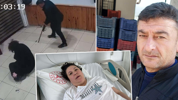 Boşanma aşamasındaki eşi tarafından vuruldu, bacakları ampute edildi! ‘Pes’ dedirten savunma: Sevdiğim için oldu
