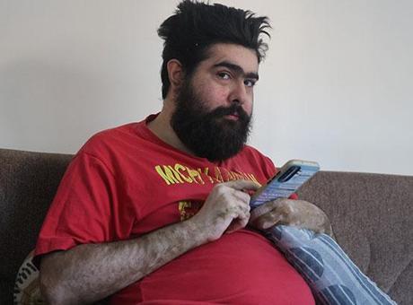 Aylarca tedavi gördü, eve döndü, yeniden telefon başına geçti: İyileşmek istemiyorum