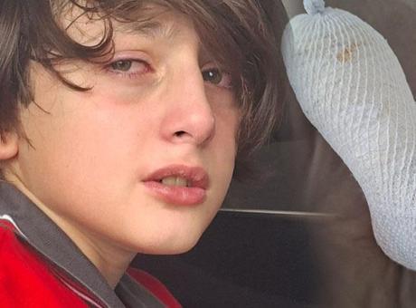 Ödül olarak alınan oyuncak elinde patladı! 11 yaşındaki Furkan 2’nci derece yandı