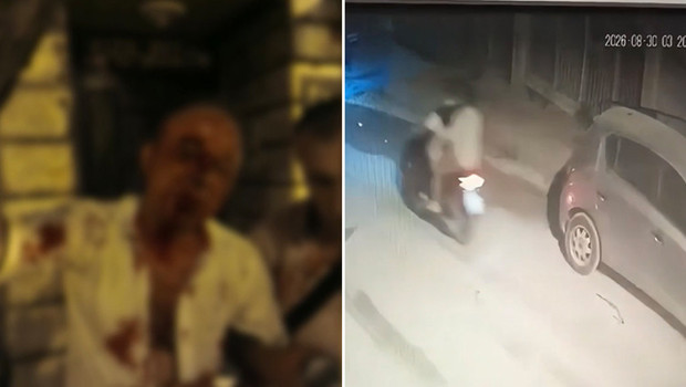 Sokak ortasında ‘yan bakma’ kavgası! Kanlar içinde konuştu: Her şeyim patladı