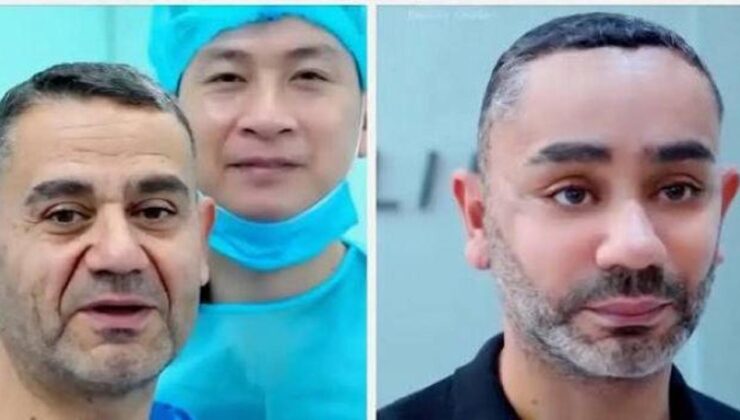 58 yaşında gençleşmek istedi, Vietnam’a gitti! Türk uzmandan olay estetik yorumu