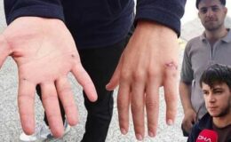 Çocukluk arkadaşının ölümünü anlattı: İşten çıkarılma korkusuyla mecbur kaldık