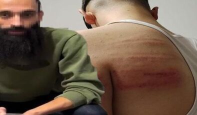 2 çırağı demir sopayla dövdüğü iddia edilmişti! Berber yeniden gözaltında
