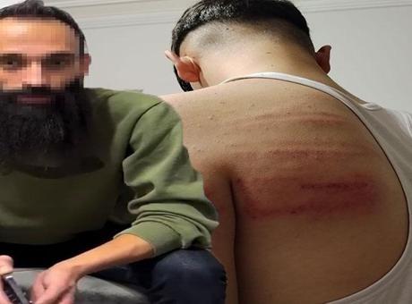 2 çırağı demir sopayla dövdüğü iddia edilmişti! Berber yeniden gözaltında