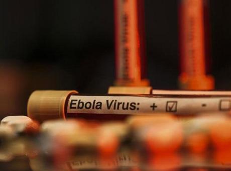 Nijerya’da ilk Ebola virüsü vakası tespit edildi