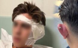 Piercing sonrası hastanelik olmuştu! Korkunç olay sonrası yeni gelişme